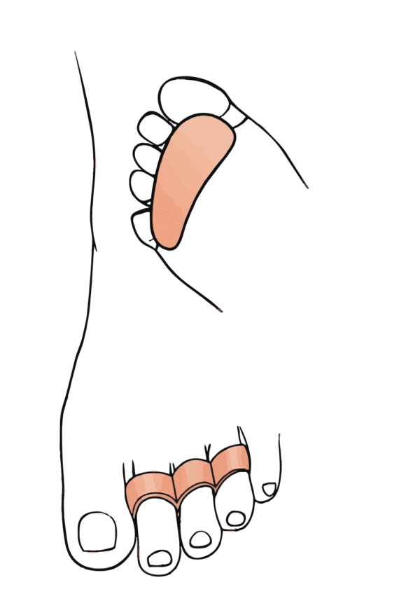 پد فاصله دهنده سه انگشتی  OTESSY free size فروشگاه پزشکی پدر طالقانی کرج - Image 2