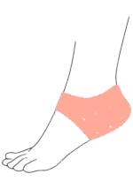 محافظ پاشنه پا سیلیکونی با بند فیکساتور  OTESSY free size فروشگاه پزشکی پدر طالقانی کرج - Image 2